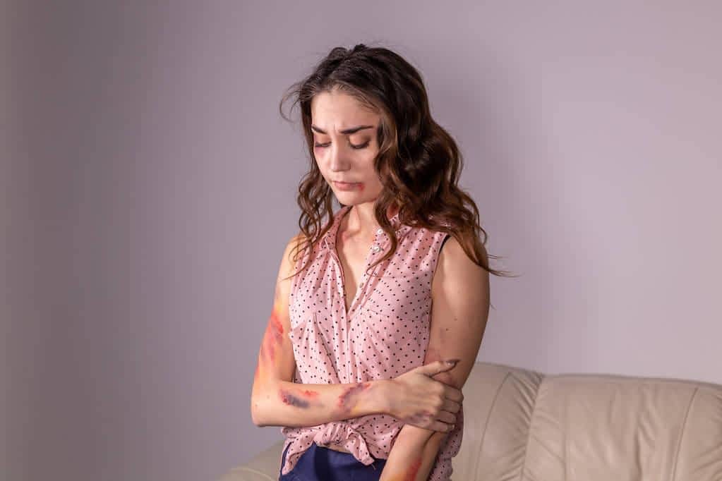 7 Signs Connecting Emotional Immaturity and Abusive Relationships 5 violence issues woman victim of domestic violence and abuse